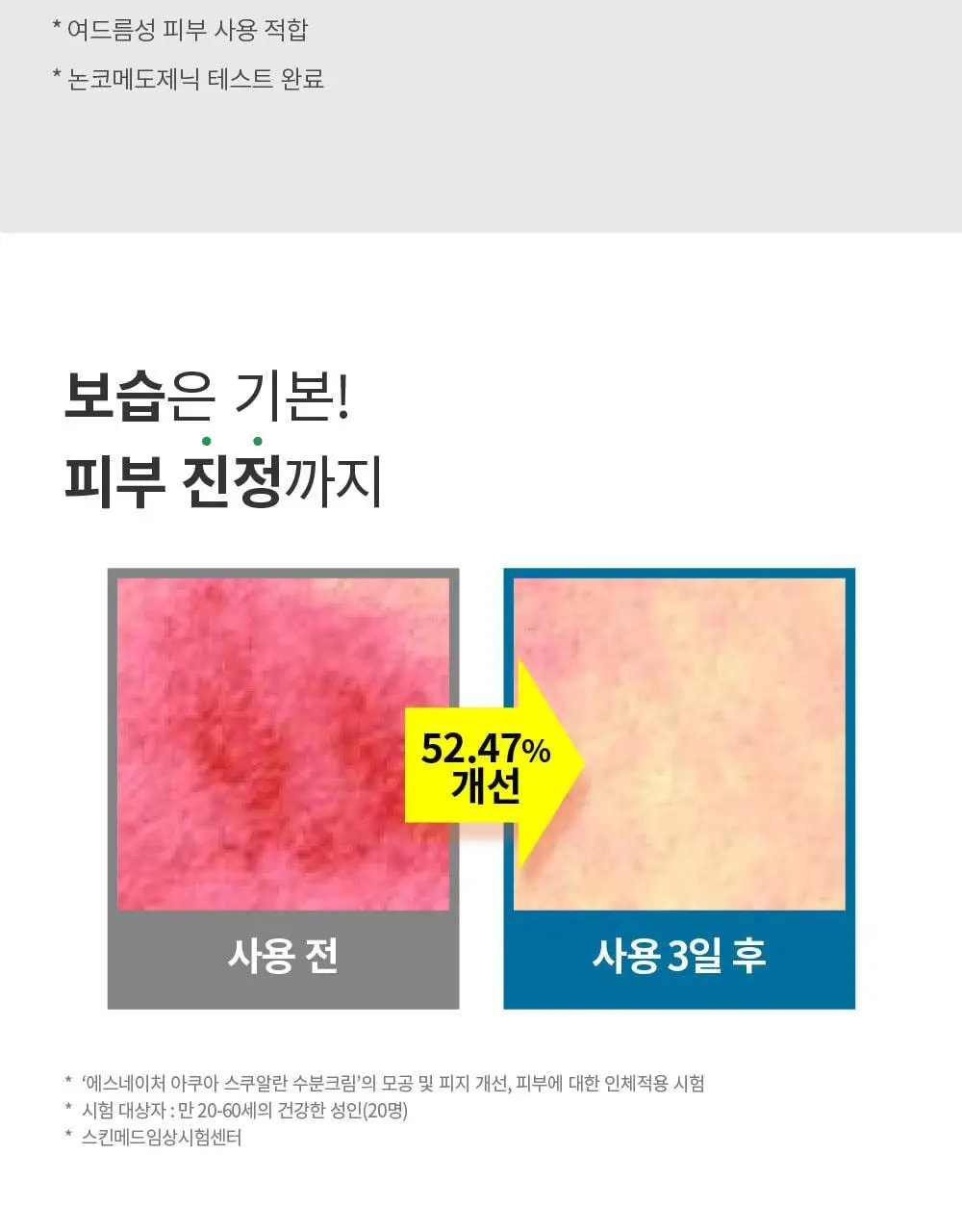 [1+1/1등 모공 수분천재크림] 에스네이처 아쿠아 스쿠알란 수분크림 60ml 더블기획 (+발렌 파우치 키링) 상세페이지 37